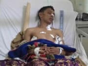 Pergoki Aksi Pencurian Pedagang di Tangerang Malah Ditusuk
