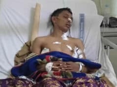 Pergoki Aksi Pencurian Pedagang di Tangerang Malah Ditusuk
