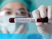 Pemkot Serang Didesak Lakukan Rapid Tes Untuk Deteksi Sebaran Corona