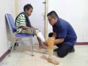 Kaki Palsu Untuk Capil