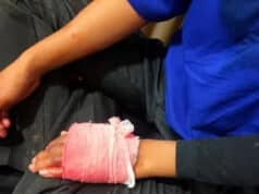 Begal Beraksi di Tangerang, Mamah Muda Bonceng 2 Anak Dibacok Pelaku di Door