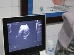 Puskemas di Kota Tangerang Beri Layanan USG Gratis, Salah Satunya Ada di Cipondoh Puskemas di Kota Tangerang Beri Layanan USG Gratis, Salah Satunya Ada di Cipondoh